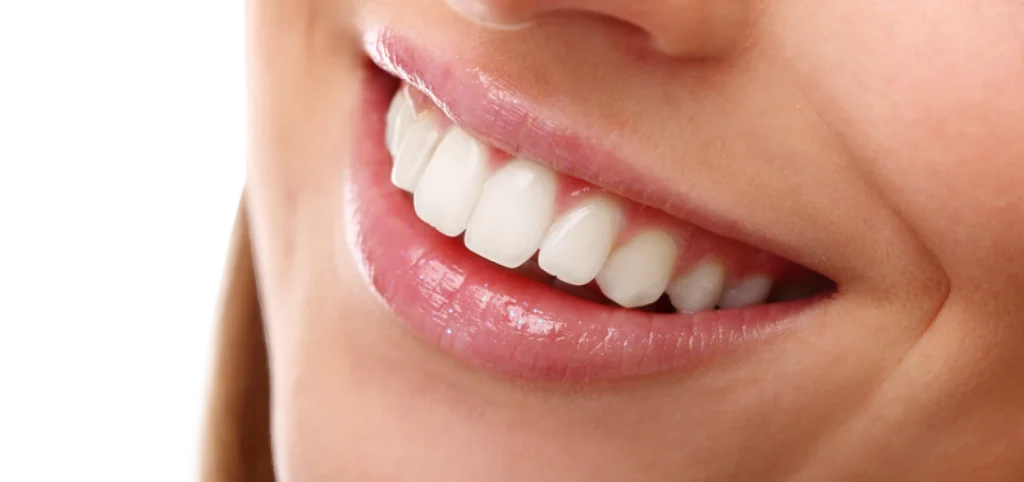 Parcours de soins orthodontique à Montigny-le-Bretonneux